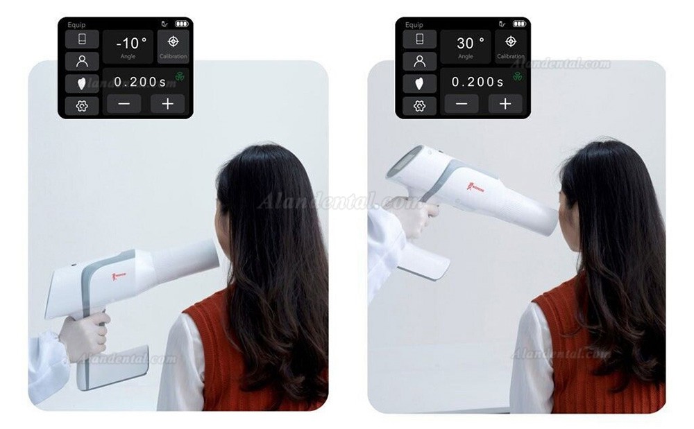 Woodpecker Ai Ray Dental Portable X-Ray Machine Imported High Frequency Tube